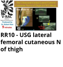 RR10 - USG lateral femoral cutaneous N of thigh